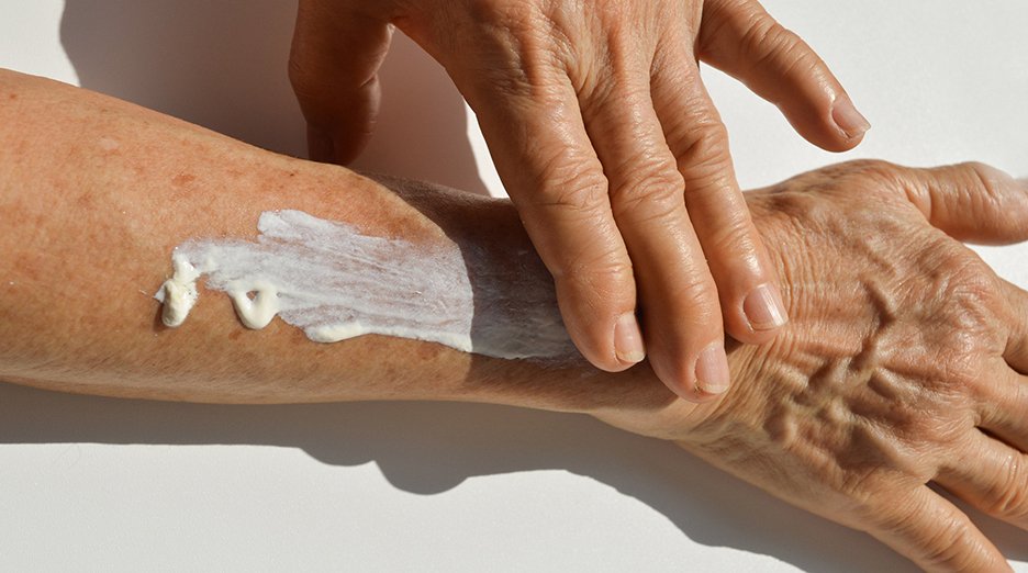 A hand applies a generous amount of white cream to another hand, highlighting the importance of moisturizing to reduce the appearance of dark spots.