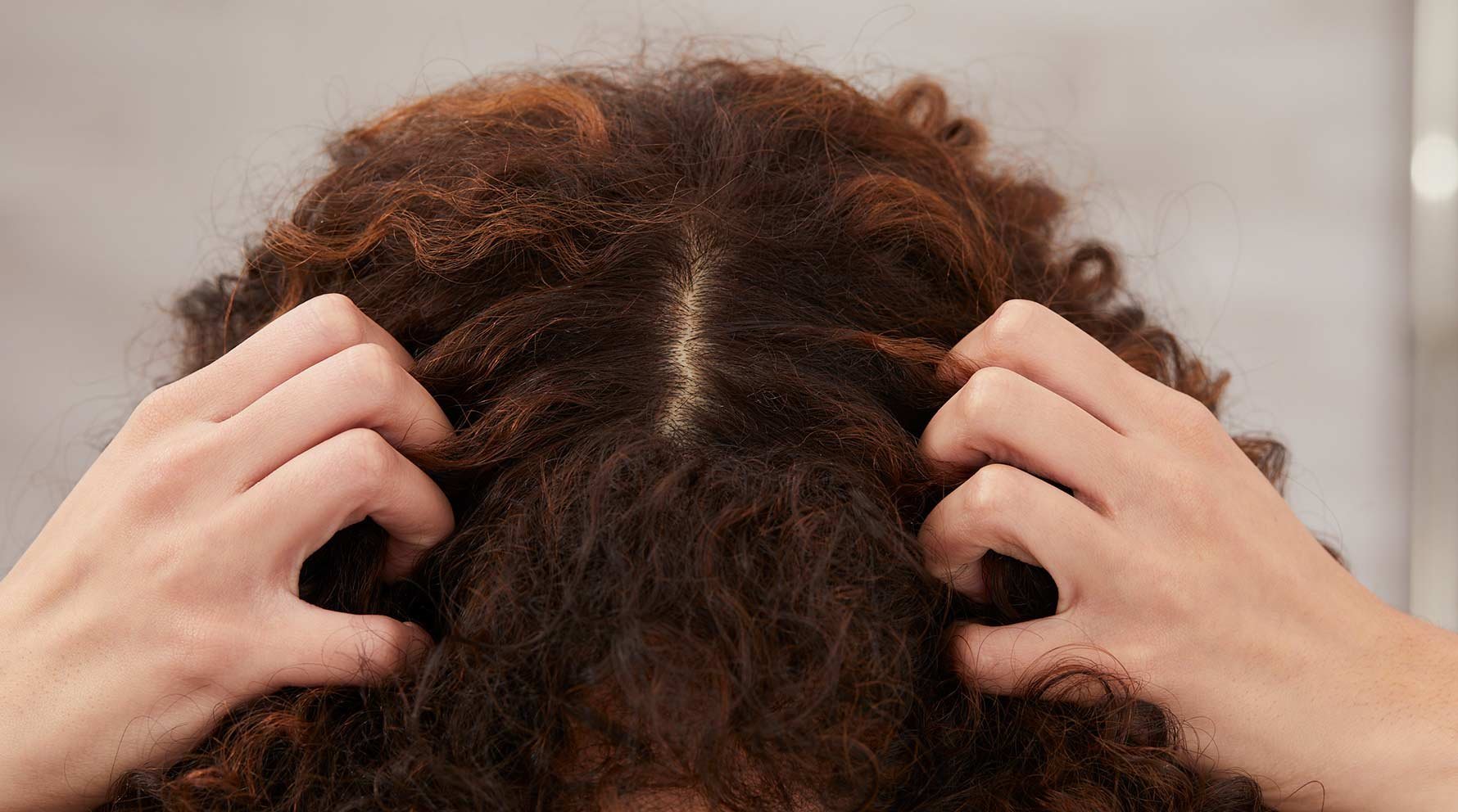 How to Give Your Itchy Scalp Relief - Garnier How to Give Your Itchy Scalp Relief - Garnier