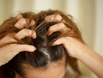Factors that cause an itchy scalp - Garnier
