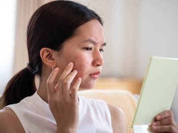 What does oily skin look like - Garnier