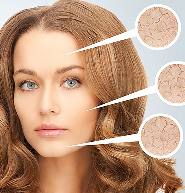 Dry Skin Treatments Expert Tips for Winter Skin Care Garnier