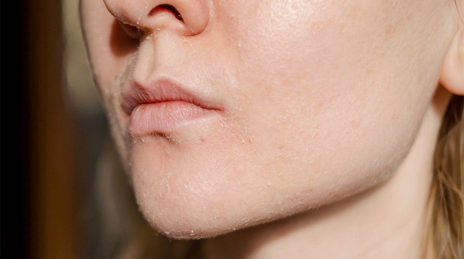 How to soothe irritated skin - Garnier