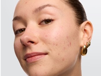 Common teenage skin concerns - Garnier