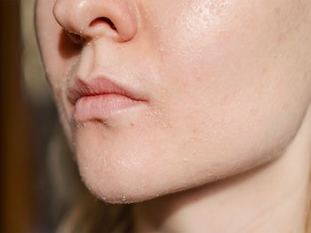 Close-up of lips and chin area.