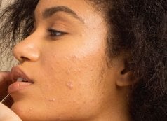 Glycolic Acid Treatment Against Acne - Garnier