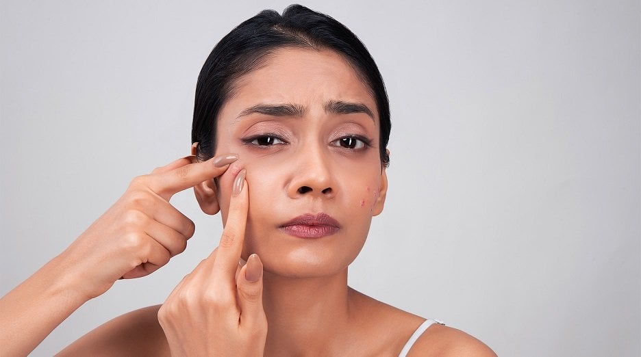 Boyfriends beard causing breakouts - Garnier