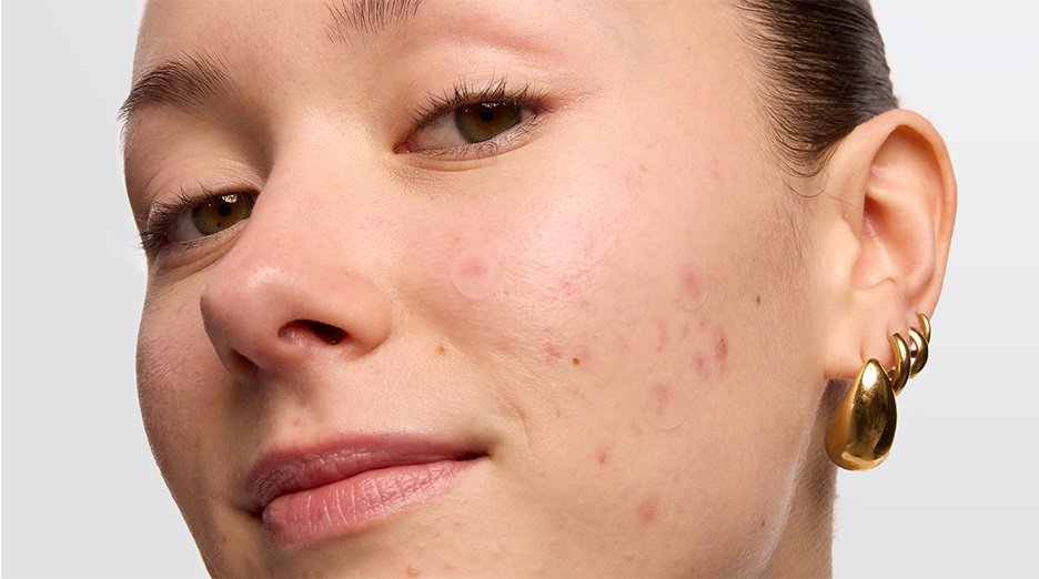 Blackhead skin care routine - Garnier