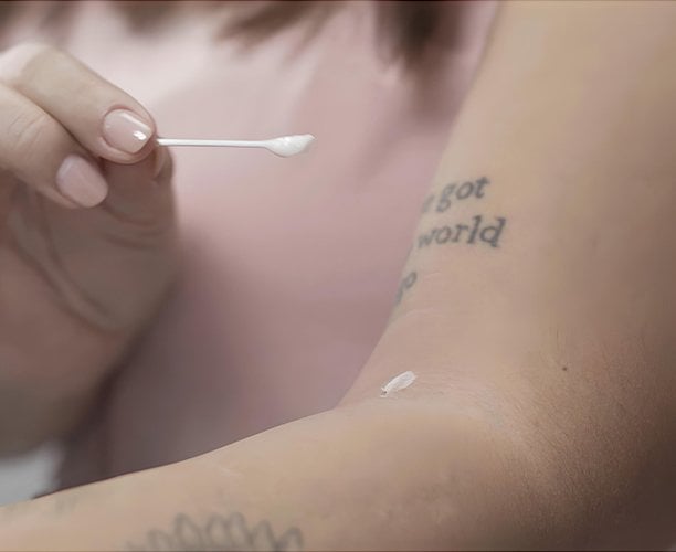 Prueba de alergia