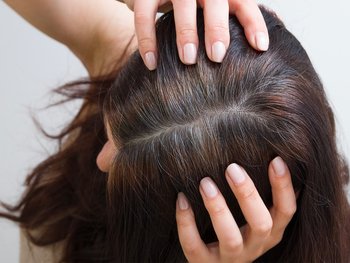 Close-up photo of a woman showing her scalp with gray hairs