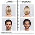 Before and after results of female and male using Hair Filler + Polypeptides Fullness Repair system
