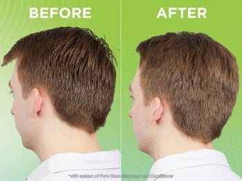 A side-by-side "before and after" comparison of a man's short brown hair from behind against a vibrant green background. The "before" image on the left shows hair that appears greasy, separated, and piecey. The "after" image on the right displays clean, fluffy, and voluminous hair with uniform texture. Disclaimer text at the bottom notes results are achieved with the system of Pure Clean Shampoo and Conditioner.