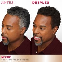 A side-by-side comparison of a man's temples showing gray hair ("BEFORE") and black hair ("AFTER") after using the root retouch.