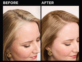 The "Before" image shows a woman's scalp with noticeable gray roots. The "After" image taken after applying Olia, reveals a consistent light-brown color with full gray coverage.