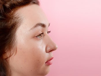 A close-up of a nose with visible blackheads.